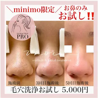 Eyelash salon MORE(モア)所属・安納 麻穂のエステ・リラクイメージ