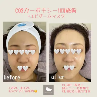 1ヶ月後も半分残る 高持続LEDエクステのマツエク・マツパデザイン