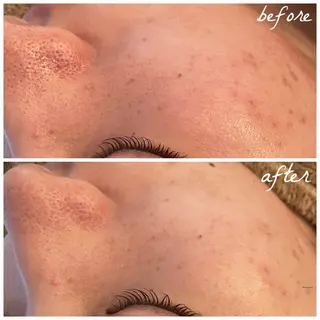 メンズ メナード岐阜市茜部 杉浦のエステ・リラクイメージ