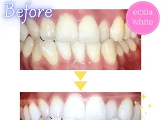 セルフホワイトニング エクシア浜松店のエステ・リラクイメージ