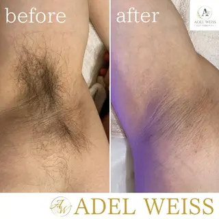 Total Beauty Salon　ADEL WEISS所属・ADEL WEISS 脱毛＆毛穴＆リンパのエステ・リラクイメージ