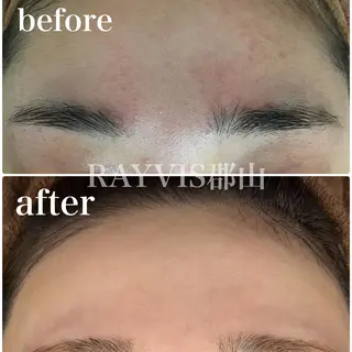 🌹毛穴小顔エステ レイビス郡山店🌹のエステ・リラクイメージ