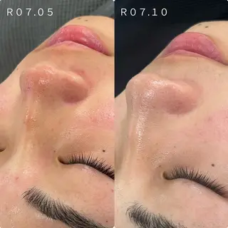 Venus所属・エステサロン Venusのその他イメージ