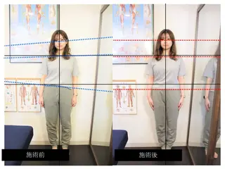 ピュアプロポーション美容整体カイロ院所属・小顔/美姿勢/肩凝り ピュアプロポーションのエステ・リラクイメージ