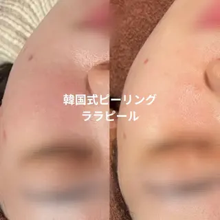 【LEPUS】レプス nishimoriのエステ・リラクイメージ