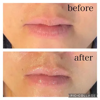 leolo武蔵浦和 肌質改善＆脱毛のエステ・リラクイメージ