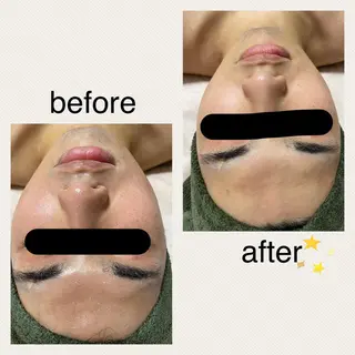 メンズ salon_ A所属・MAE ASUKAのエステ・リラクイメージ