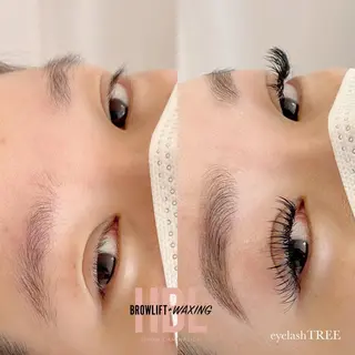 マツエク・マツパ まつげ、毛穴 TREEのエステ・リラクイメージ