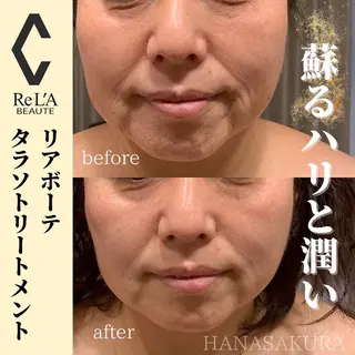 HANASAKURA所属・HANASAKURA 心斎橋のエステ・リラクイメージ