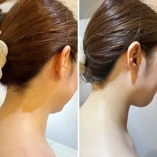 うなじ脱毛/美肌脱毛 LABELのエステ・リラクイメージ