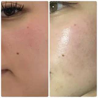 脱毛&フェイシャル 専門店muro.のエステ・リラクイメージ