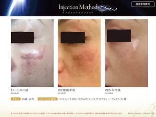 リュー・.ド・ボウテ所属・肌質改善サロン★ リュー・ド・ボウテのエステ・リラクイメージ