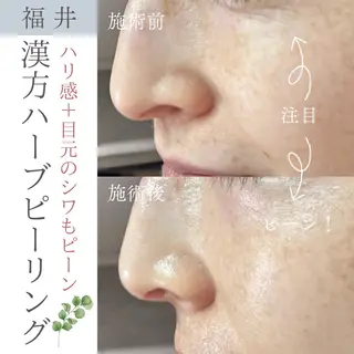 毛穴肌質ケアサロン Yourmeユアミーのエステ・リラクイメージ