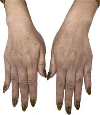 ネイル MAXKELLY AIのネイルデザイン