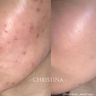 BABY BASH BROW×SKIN所属・FUJIMOTO AOIのエステ・リラクイメージ