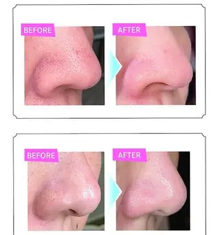 jessica/ 平野🪄︎︎◝✩のマツエク・マツパデザイン