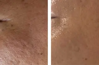 mimiBrun 肌質改善サロンのエステ・リラクイメージ