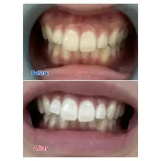 M渋谷店所属・M渋谷 ホワイトニングのエステ・リラクイメージ