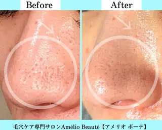毛穴ケア専門サロン Amélio Beauté所属・毛穴ケア専門サロン アメリオボーテのその他イメージ