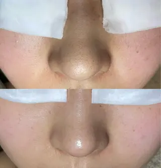 Re:Belle所属・Re:Belle 久留米 : 中島のエステ・リラクイメージ