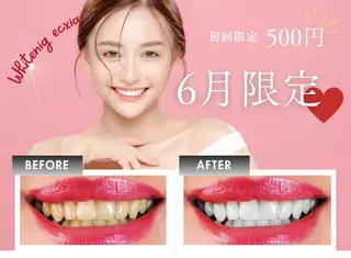 セルフホワイトニング エクシア徳島店のその他イメージ