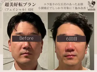 総合美容サロン LOVEME渋谷本店のエステ・リラクイメージ