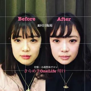 きらめきワンライフ Yumaのエステ・リラクイメージ