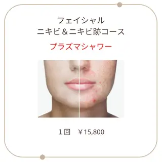 ベラージュ【美背中・ 美尻・フェイシャル】のエステ・リラクイメージ