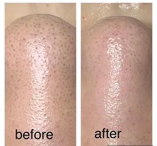 NAO 🌺のマツエク・マツパデザイン