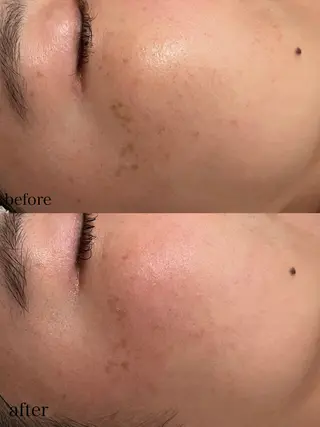 ポテンツァ&針美容 バストアップ専門店のエステ・リラクイメージ