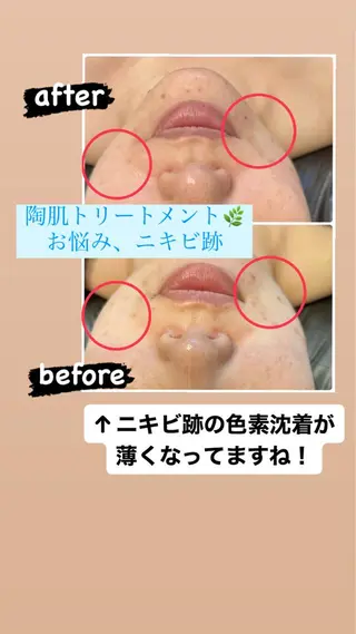 喜山 あつこのエステ・リラクイメージ