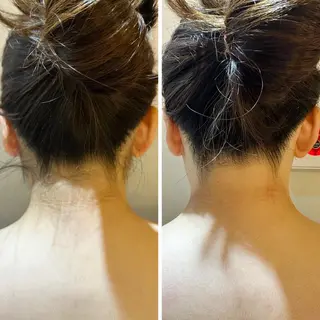 うなじ脱毛/美肌脱毛 LABELのエステ・リラクイメージ