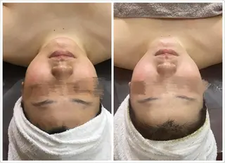 OPREA 千種店のエステ・リラクイメージ