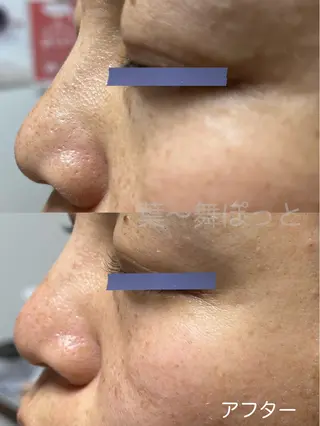 うえつま ふみえのエステ・リラクイメージ