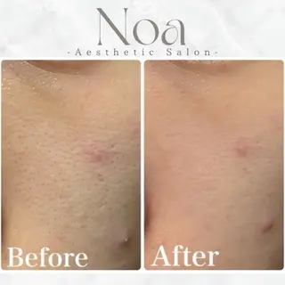 エステサロンNoa所属・肌質改善サロン Noaのエステ・リラクイメージ