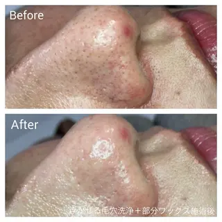 深い肌悩み専門 フェイシャルサロンのエステ・リラクイメージ