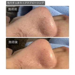 心斎橋痩身ダイエット 韓国.美容鍼.小顔のエステ・リラクイメージ