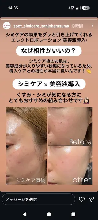 tms. mn.のエステ・リラクイメージ