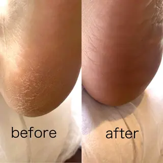 ネイル moriyu nailのネイルデザイン