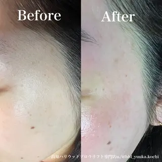 ハリウッド ブロウリフト専門店の眉毛・アイブロウイメージ