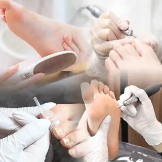 巻き爪補正店 大阪天王寺店のネイルデザイン