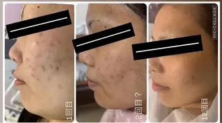 北谷Dei'm所属・~Luxe31~ ありさのエステ・リラクイメージ