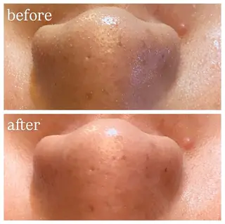 肌質改善専門 ハーブ /毛穴洗浄 リエイトのエステ・リラクイメージ