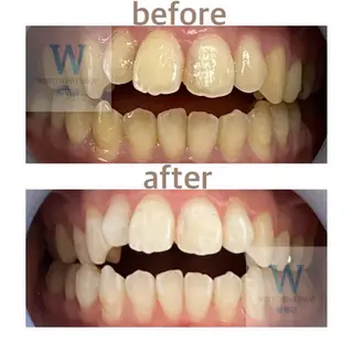 ホワイトニング ショップ船橋2号店のエステ・リラクイメージ