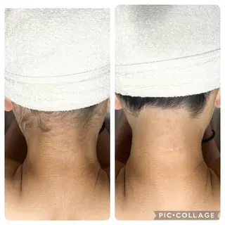 都度払い脱毛サロン Haleのエステ・リラクイメージ