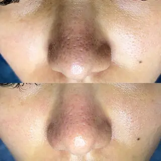 毛穴ケア・ヘッドスパサロンSHINY(シャイニー)所属・毛穴ケア・ヘッドスパ サロンSHINYのエステ・リラクイメージ