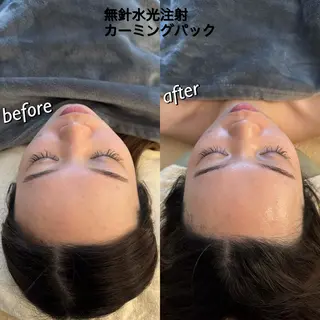 うなじ脱毛/美肌脱毛 LABELのエステ・リラクイメージ