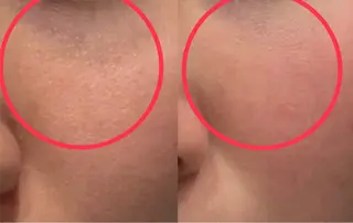 小顔/たるみ/黒ずみ除去専門サロン/SONA 大和西大寺店所属・【小顔専門看護師 サロンSONA】のエステ・リラクイメージ