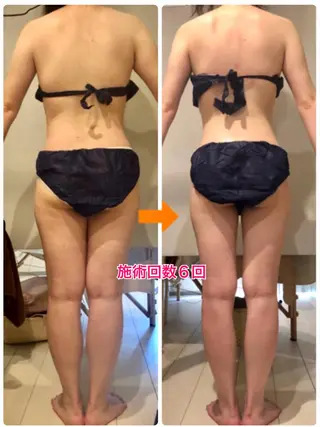 ロング カラー パーマ ヘアアレンジ メンズ キッズ ネイル マツエク・マツパ ‍痩身＆ボディ 結果出し🌟丹野のエステ・リラクイメージ