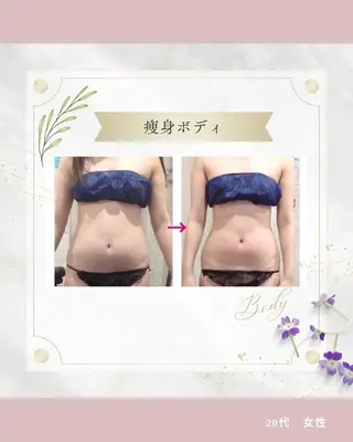 《 痩身専門 》 addissimoのエステ・リラクイメージ